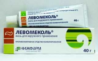 Гранулема пирсинга носа