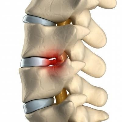 Может ли болеть в паху от спины