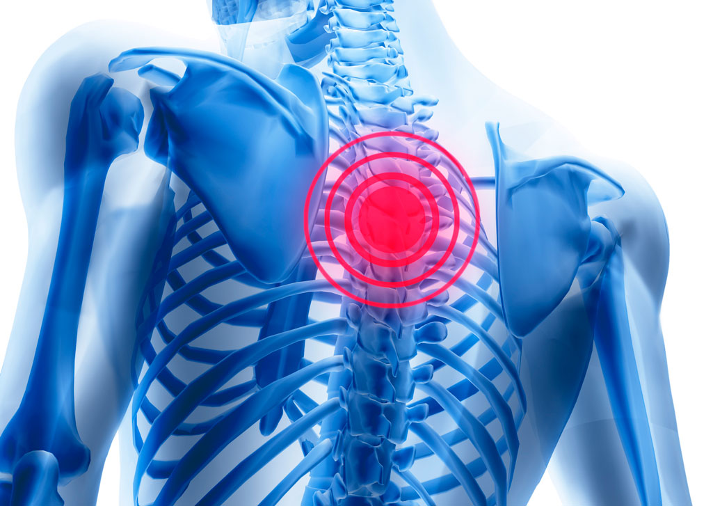 К какому врачу обратиться если болит спина между лопатками