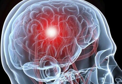 голова болит и чувство головокружения что это