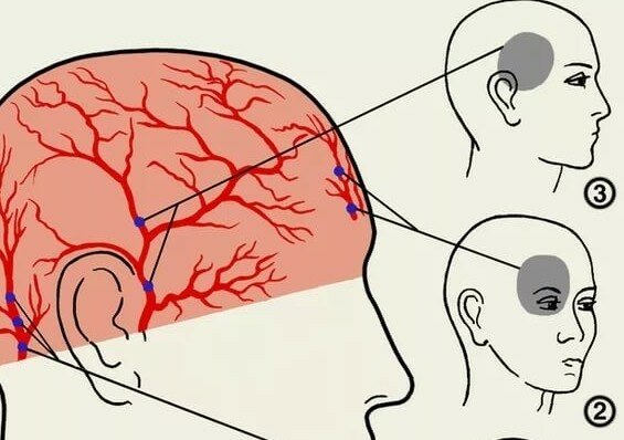 болят глаза и голова что делать