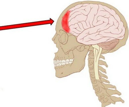 Болит голова лобная часть что может быть