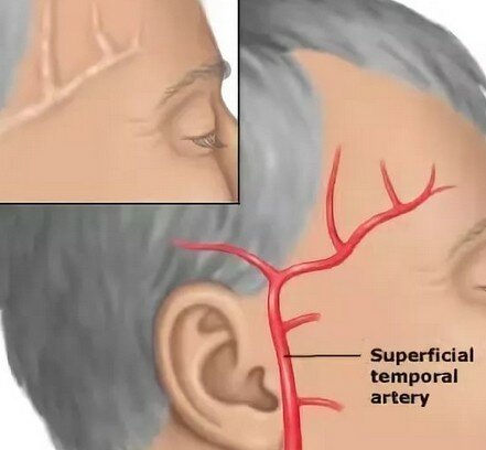 болит правый висок головы несколько дней