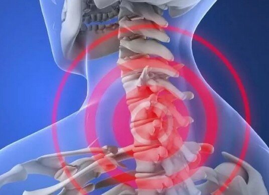 Болит шея внизу головы