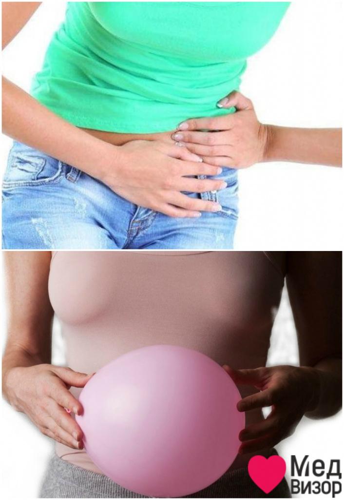 Дивертикулез симптомы: боли в нижней левой части живота, могут отдавать в спину; вздутие живота Диарея температура болит спина