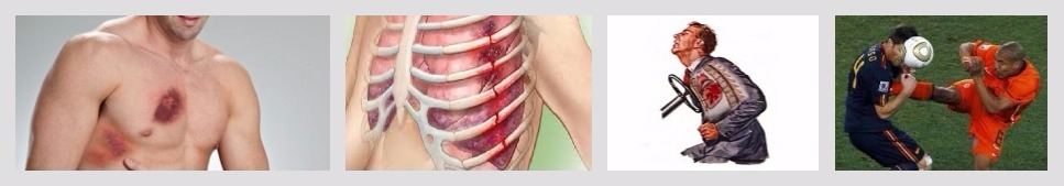 От ушиба грудной клетки болит спина