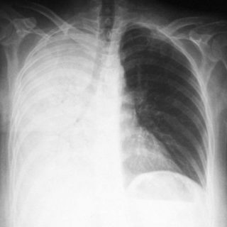 Почему болит внизу спины слева у женщин