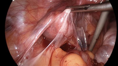 Болит спина в правом боку и тянет ногу