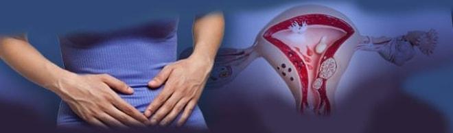 Как проявляет себя боль при кисте яичника