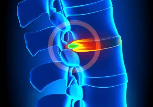 Болит спина в области лопаток и шеи чем лечить