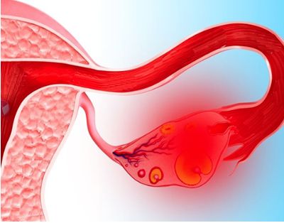 Болит спина в правом боку и тянет ногу