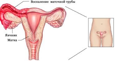 Болит спина в правом боку и тянет ногу