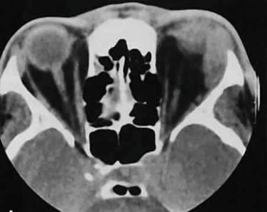 Температура несколько дней и болит спина