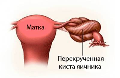 Болит спина в правом боку и тянет ногу