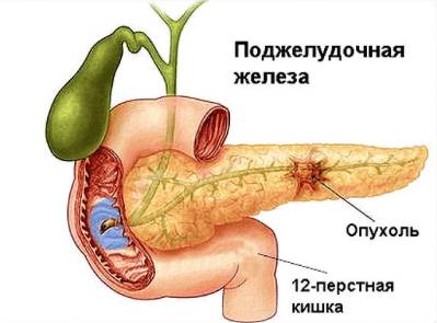 Болит спина в правом боку и тянет ногу