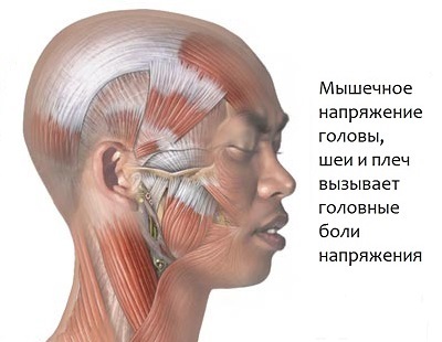 Панические атаки часто болит голова