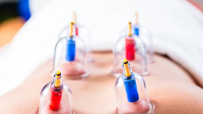 Хиджама процесс