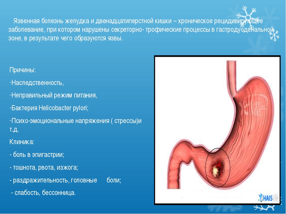 Что болит в левом подреберье отдает в спину