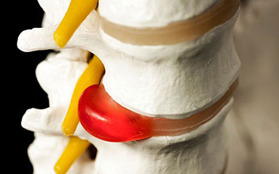 Может ли болеть в паху от спины