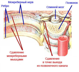 Болит со стороны спины за ребрами