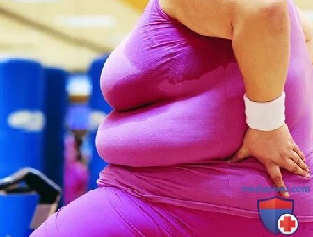 Ожирение и боль в суставах