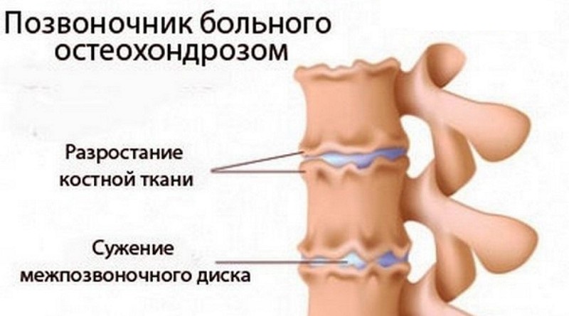 К какому врачу обратиться если болит спина между лопатками