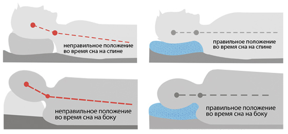 как выбрать ортопедическую подушку