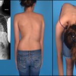 Болит грудная клетка посередине отдает в спину